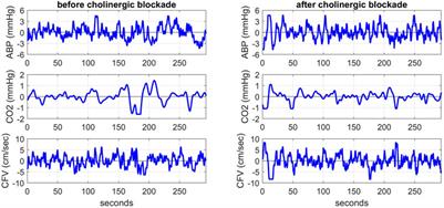 Dynamic effects of cholinergic blockade upon cerebral blood flow autoregulation in healthy adults